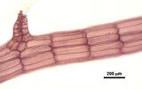 6 - Dettaglio delle periassiali
